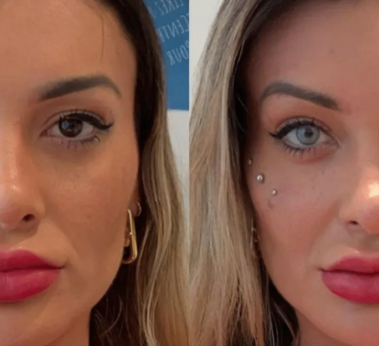 Andressa Urach desabafa sobre cirurgia para mudar a cor dos olhos: “Não vale a pena a dor!”